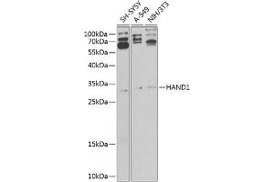 Western blot analysis of extracts of various cell lines, using H antibody (ABIN6128001, ABIN6141595, ABIN6141596 and ABIN6225185) at 1:1000 dilution. (HAND1 Antikörper  (AA 16-215))