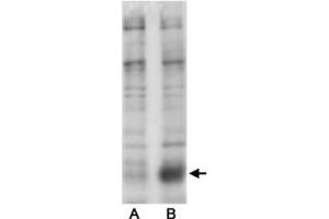 Western blot analysis of Phospho-Slc9a3 S605 in transfected COS-7 cells (Lane A. (SLC9A3 Antikörper  (pSer605))
