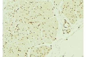 ABIN6276512 at 1/100 staining Mouse muscle tissue by IHC-P. (SMAD1 Antikörper  (Internal Region))