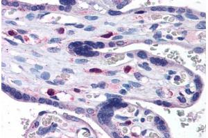 Human Placenta: Formalin-Fixed, Paraffin-Embedded (FFPE) (SNX16 Antikörper  (AA 2-14))