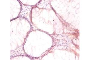 Immunohistochemistry (IHC) image for anti-ATPase, H+ Transporting, Lysosomal 13kDa, V1 Subunit G1 (ATP6V1G1) (AA 2-118) antibody (ABIN7175262)