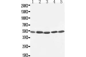 Anti-TIM 1 antibody, Western blotting Lane 1: SMMC Cell Lysate Lane 2: HELA Cell Lysate Lane 3: PANC Cell Lysate Lane 4: M231 Cell Lysate Lane 5: M453 Cell Lysate (HAVCR1 Antikörper  (C-Term))