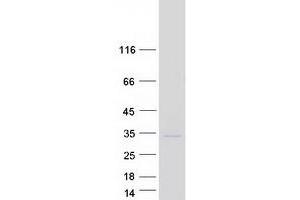 Validation with Western Blot (RAB3A Protein (Myc-DYKDDDDK Tag))