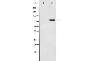 Western blot analysis of p73 phosphorylation expression in Pervanadate treated K562 whole cell lysates,The lane on the left is treated with the antigen-specific peptide.