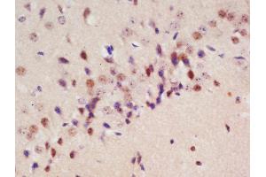Formalin-fixed and paraffin embedded rat brain labeled with Rabbit Anti-Drebrin Polyclonal Antibody, Unconjugated (ABIN873130) at 1:200 followed by conjugation to the secondary antibody and DAB staining