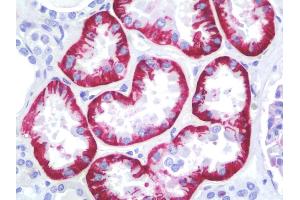 Human Kidney: Formalin-Fixed, Paraffin-Embedded (FFPE)