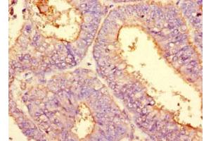 Immunohistochemistry (IHC) image for anti-Podocalyxin-Like (PODXL) antibody (ABIN7163728)