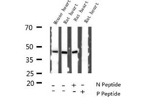 Western blot analysis of Phospho-GATA4 (Ser262) expression in various lysates (GATA4 Antikörper  (pSer262))