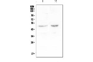 Western blot analysis of PAFAH using anti-PAFAH antibody (ABIN6719581).