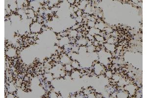 ABIN6279755 at 1/100 staining Mouse lung tissue by IHC-P.