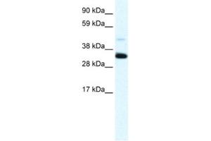 Western Blotting (WB) image for anti-Annexin A3 (ANXA3) antibody (ABIN2461372) (Annexin A3 Antikörper)
