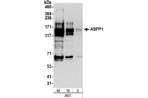 anti-Protein Phosphatase 1, Regulatory Subunit 13B (PPP1R13B) (AA 475-525) antibody