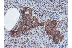 Image no. 2 for anti-Crystallin, Zeta, Homolog antibody (ABIN1497654) (CRYZL1 Antikörper)