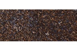 Immunohistochemistry of paraffin-embedded Human tonsil tissue using LMNB1 Polyclonal Antibody at dilution of 1:60(x200) (Lamin B1 Antikörper)