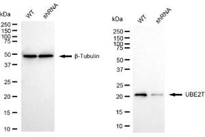 Western blotting analysis using UBE2T antibody (ABIN7800753). (Rekombinanter Ube2t Antikörper)
