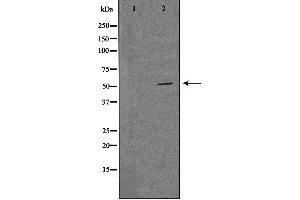 Western blot analysis of extracts from LOVO cells, using MRPS30 antibody. (MRPS30 Antikörper  (C-Term))