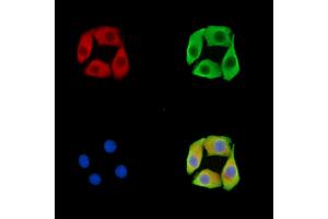 ABIN7095825 and ABIN7099887 staining Hela cells by IF/ICC. (RNF170 Antikörper)