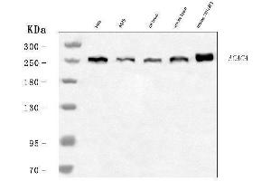 Western blot analysis of ACACA using anti-ACACA antibody (ABIN7602842).