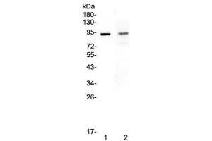 Western blot testing of 1) rat spleen and 2) mouse intestine lysate with TLR1 antibody at 0. (TLR1 Antikörper)