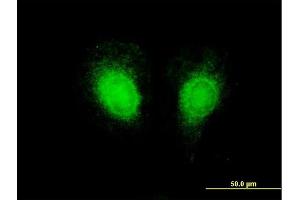 Immunofluorescence of purified MaxPab antibody to CSF2 on HeLa cell. (GM-CSF Antikörper  (AA 1-144))