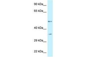 Image no. 1 for anti-6-phosphofructo-2-Kinase/fructose-2,6-Biphosphatase 1 (PFKFB1) (AA 335-384) antibody (ABIN6747350) (PFKFB1 Antikörper  (AA 335-384))