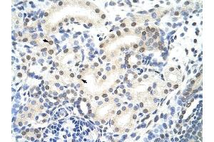 SNRP70 antibody was used for immunohistochemistry at a concentration of 4-8 ug/ml to stain Epithelial cells of renal tubule (arrows) in Human Kidney. (SNRNP70 Antikörper)