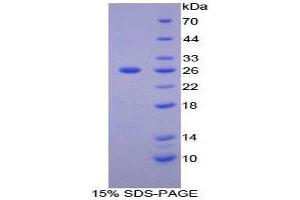SDS-PAGE (SDS) image for Matrix Metallopeptidase 11 (Stromelysin 3) (MMP11) (AA 277-488) protein (His tag) (ABIN1080264)