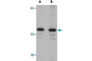 Western blot analysis of CDCA8 in rat kidney tissue lysate with CDCA8 polyclonal antibody  at (A) 1 and (B) 2 ug/mL . (CDCA8 Antikörper  (N-Term))
