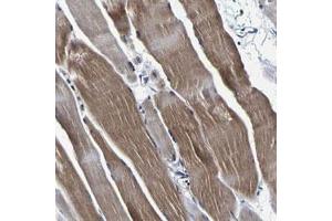 Immunohistochemical staining (Formalin-fixed paraffin-embedded sections) of human skeletal muscle with PANK4 polyclonal antibody  shows moderate cytoplasmic positivity. (PANK4 Antikörper)