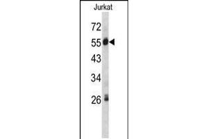 Western blot analysis of SERPING1 antibody in Jurkat cell line lysates (35ug/lane) (SERPING1 Antikörper  (AA 285-314))