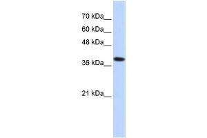 WB Suggested Anti-ATP4B Antibody Titration:  0.