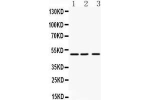 Anti- ANGPTL4 antibody, Western blotting All lanes: Anti ANGPTL4  at 0. (ANGPTL4 Antikörper  (C-Term))