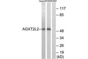 Western blot analysis of extracts from K562/HepG2 cells, using AGXT2L2 Antibody. (AGXT2L2 Antikörper  (AA 341-390))