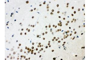 Immunohistochemistry (IHC) image for anti-Wingless-Type MMTV Integration Site Family, Member 2B (WNT2B) (AA 87-112), (N-Term) antibody (ABIN3042337)