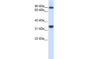 WB Suggested Anti-RRP1B Antibody Titration:  0. (RRP1B Antikörper  (Middle Region))