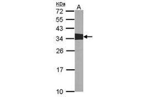 Image no. 1 for anti-V-Crk Sarcoma Virus CT10 Oncogene Homolog (Avian) (CRK) (AA 122-302) antibody (ABIN467422) (Crk Antikörper  (AA 122-302))