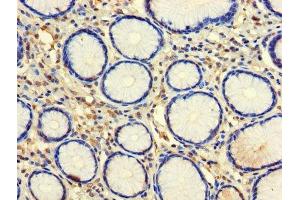 Immunohistochemistry of paraffin-embedded human stomach tissue using ABIN7146057 at dilution of 1:100 (CLEC18A Antikörper  (AA 27-446))