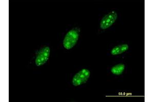 Immunofluorescence of monoclonal antibody to IQGAP3 on HeLa cell. (IQGAP3 Antikörper  (AA 602-698))