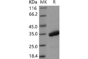 Western Blotting (WB) image for Serine Peptidase Inhibitor, Kazal Type 4 (SPINK4) protein (Fc Tag) (ABIN7320100)