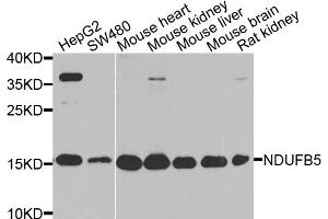 Western blot analysis of extracts of various cell lines, using NDUFB5 antibody. (NDUFB5 Antikörper)