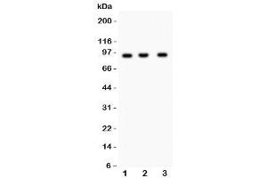 Western blot testing of NEDD9 antibody and Lane 1:  Jurkat (NEDD9 Antikörper)
