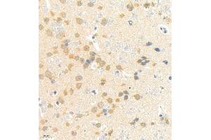 Immunohistochemistry of paraffin embedded rat brain using rasgrf1 (ABIN7073422) at dilution of 1:4000 (400x lens)