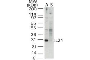 Western blot analysis of IL24 in the A) absence and B) presence of blocking peptide in Jurkat cell lysate. (IL-24 Antikörper  (AA 100-150))