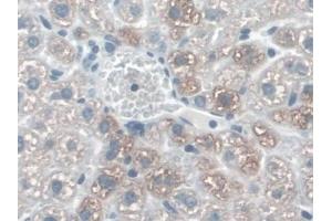 Immunohistochemistry (IHC) image for anti-Cadherin 5 (CDH5) (AA 67-390) antibody (ABIN1862306)