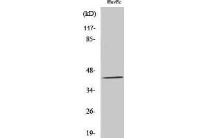 Western Blotting (WB) image for anti-Galactokinase 1 (GALK1) (N-Term) antibody (ABIN3184735) (GALK1 Antikörper  (N-Term))