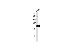 Western blot analysis of lysate from Hela cell line,using Caveolin-1 Antibody (ABIN483839 and ABIN1533222). (Caveolin-1 Antikörper)