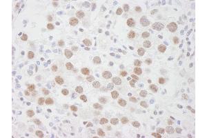 Immunohistochemistry (IHC) image for anti-DEAD (Asp-Glu-Ala-Asp) Box Polypeptide 1 (DDX1) (AA 500-550) antibody (ABIN7448512) (DDX1 Antikörper  (AA 500-550))