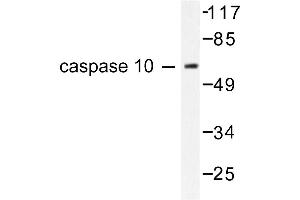 Image no. 1 for anti-Caspase 10, Apoptosis-Related Cysteine Peptidase (CASP10) antibody (ABIN265334) (Caspase 10 Antikörper)