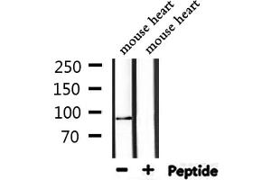 Western blot analysis of extracts from mouse heart, using TOP1 Antibody. (Topoisomerase I Antikörper  (Internal Region))