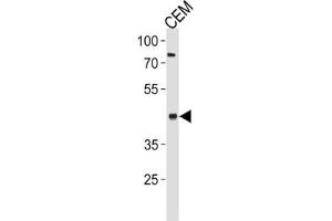 Western Blotting (WB) image for anti-Fatty Acid Desaturase 2 (FADS2) antibody (ABIN3002322) (FADS2 Antikörper)